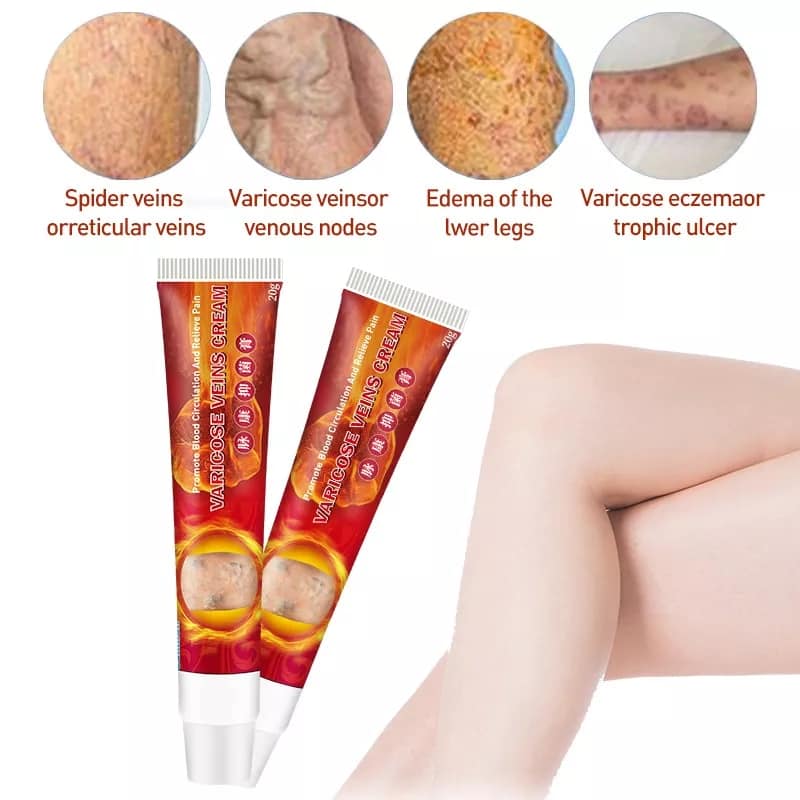 Varice 2 Veins Cream Pomada